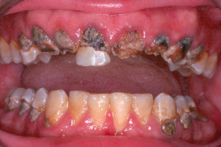 [methmouth8bsweb3ot.jpg]
