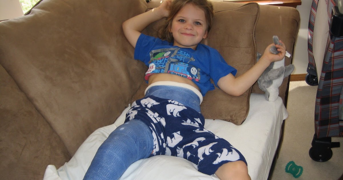 Clausen in the Hausen & out in the Garden What a one legged spica cast