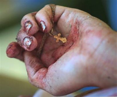 Beslan Victim Clutches Cross