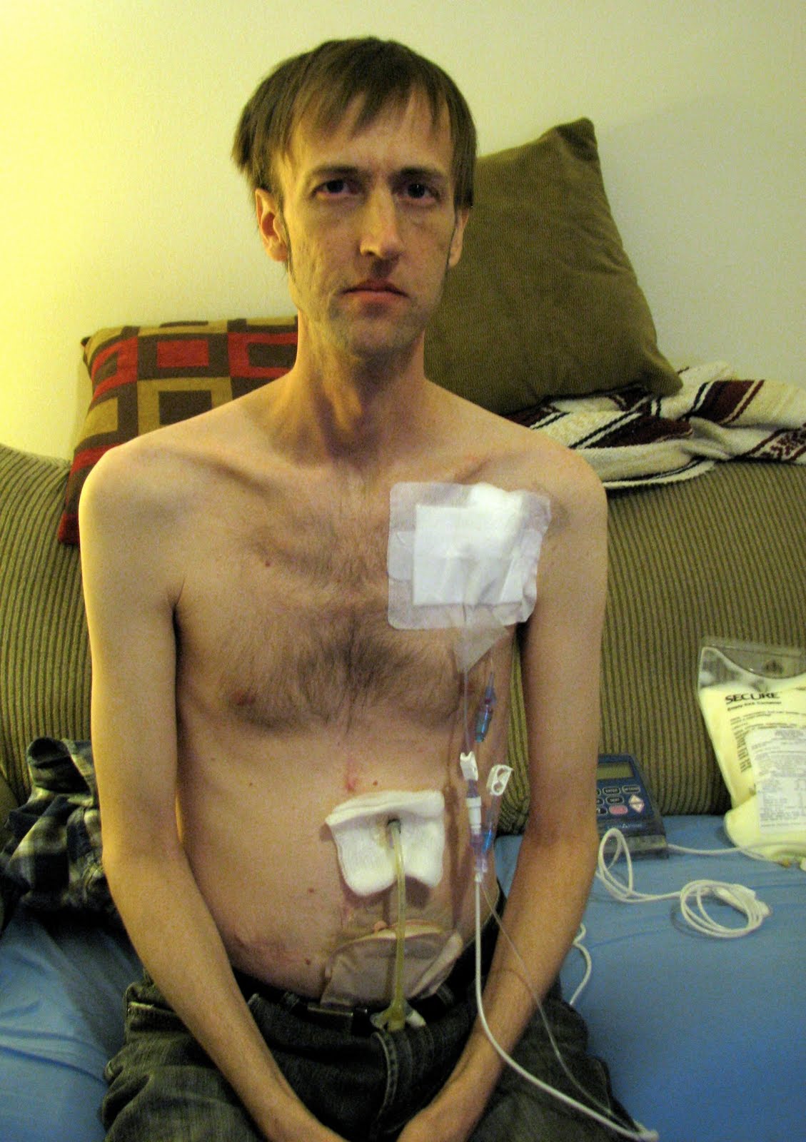 Soayacs: Stories of a Young Adult Cancer Survivor
