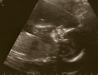 Schwangerschafts Update Woche 17 Kugelfisch Blog Der Mamablog