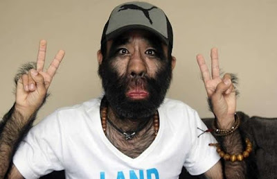 Hairiest Chinese Man Decides to Remove his Hair