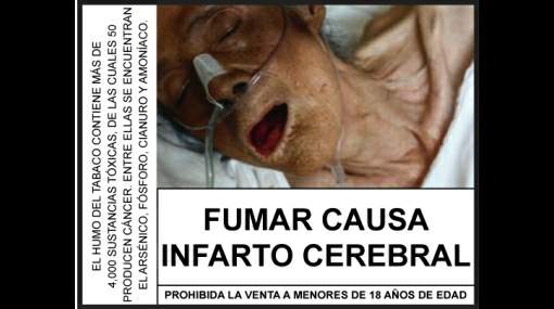 Ha dejado a fumar toso fuerte