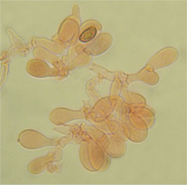 [Cortinarius+cinnamomeus+marginal+cells.jpg]