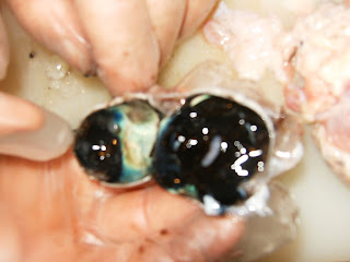 Human Eyeball Dissection