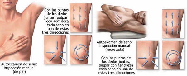 Después de mammoplastiki el pecho diferente que hacer