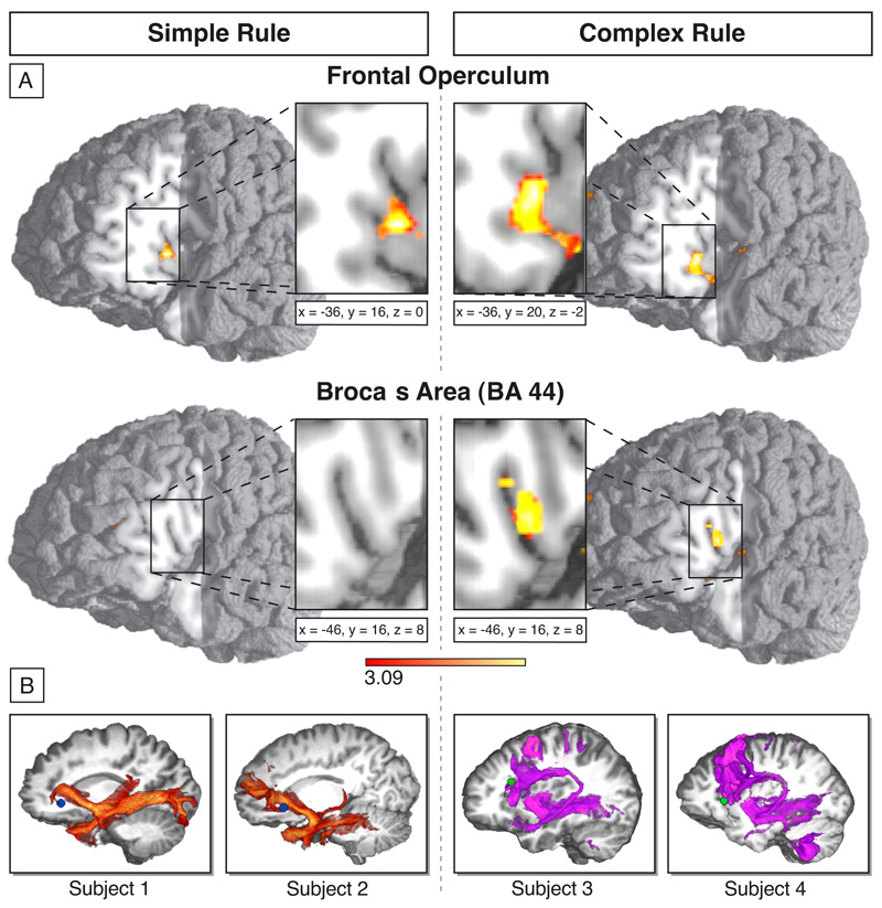 [Brain+Processing+Simple+and+Complex+language+structures.jpeg]