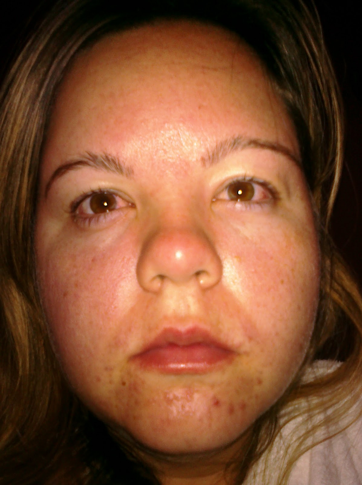 Fresh Squeezed Orange Juice ALLERGIC!