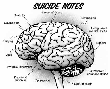 [Suicide-brainart2.jpg]