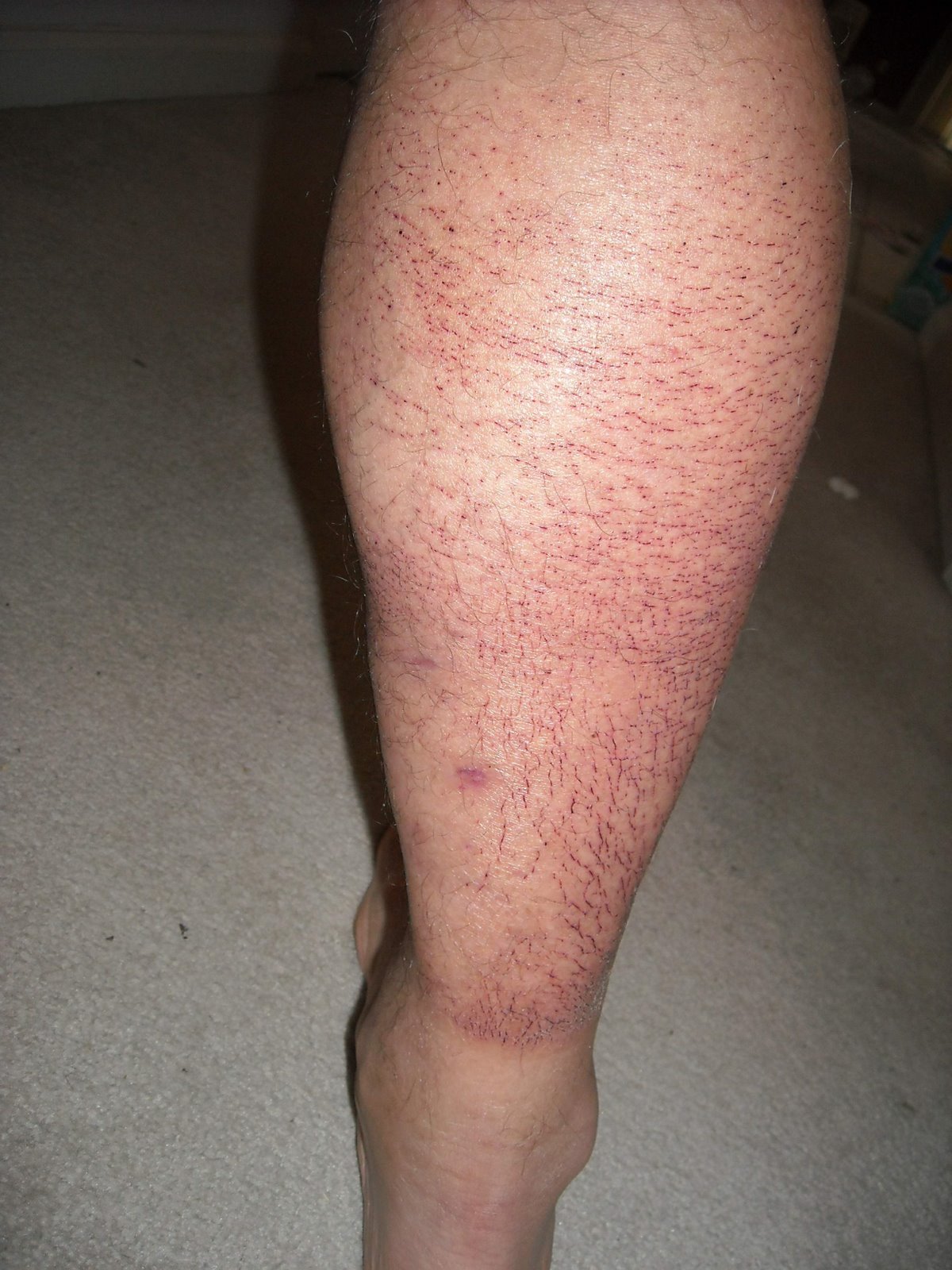 [McNaughton+leg+1.JPG]