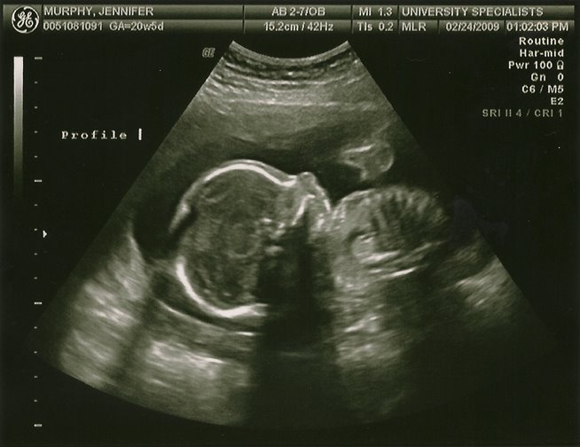 [Ultrasound1.jpg]