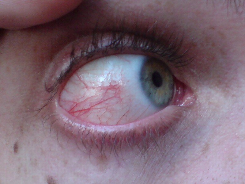 [eye.JPG]