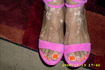 Vitiligo: Natural- Shoes by Charles David!