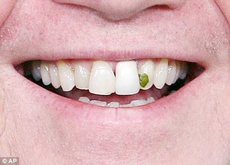 [spinach+in+teeth.jpg]