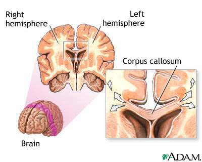 Brain/Corpus Callosum