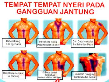 Jantung Koroner Adalah