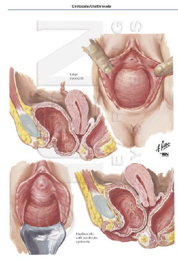 [5192-0550x0350.jpg]