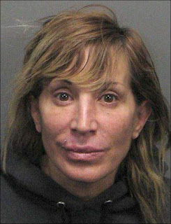 Botox Bandit