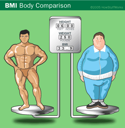 Comparison