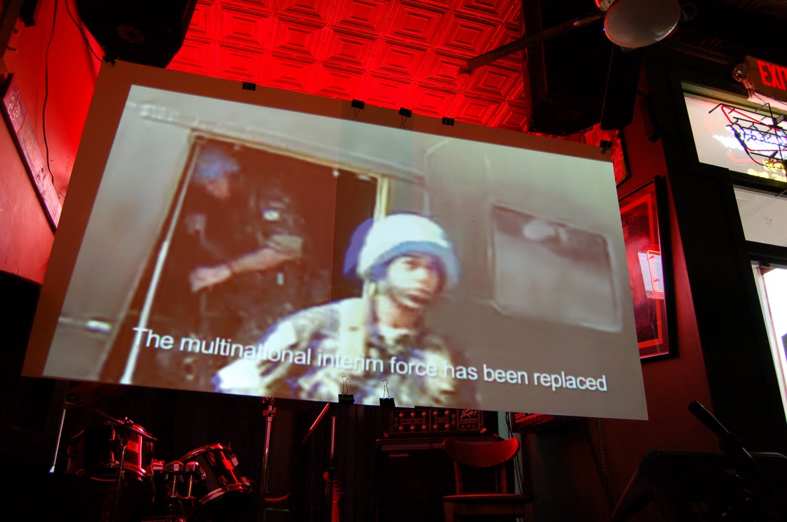 Gay Exhaust Breasts From Plastic Surgery