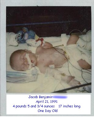 [Jacob+1+day+old++1991+3.bmp]