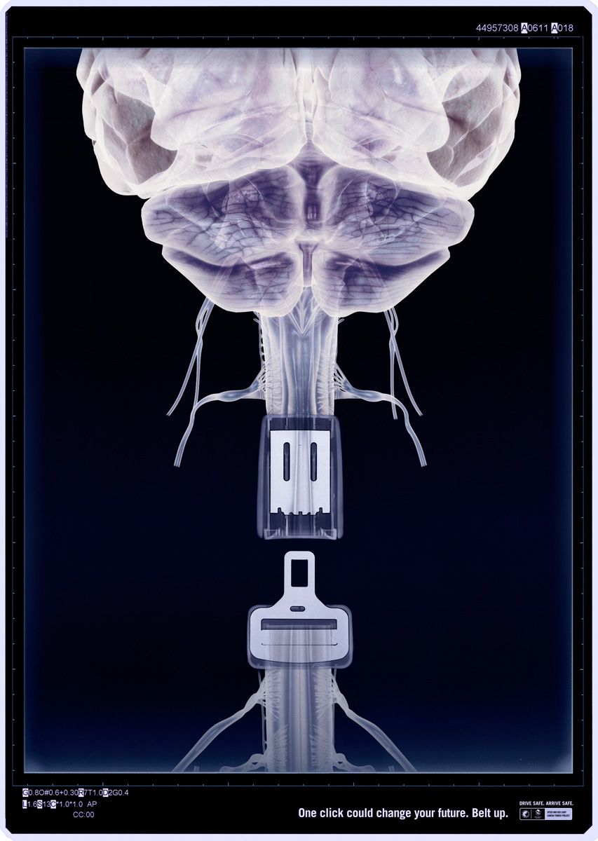 [australiaroadbrain.jpg]