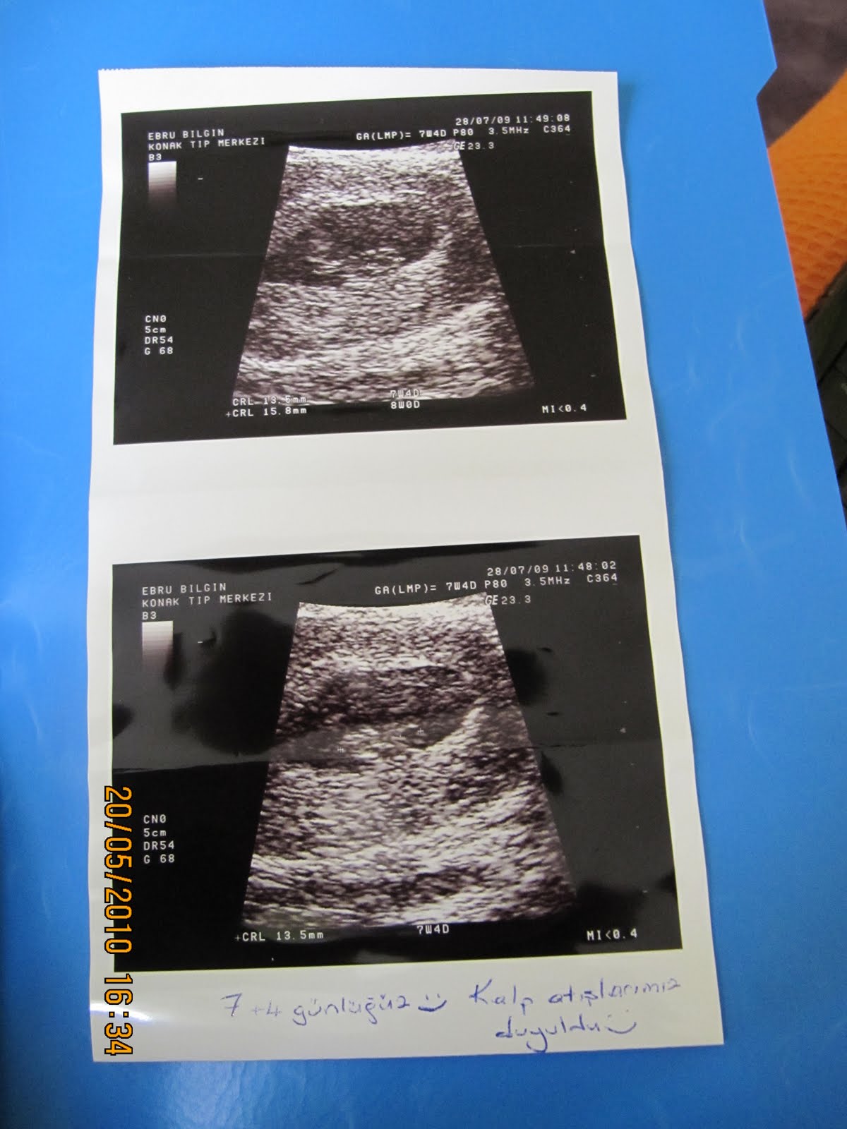 Aras Bilgin 39 haftalık muhteşem serüvenim))