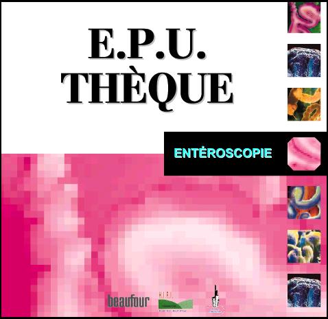 [enteroscopie.JPG]