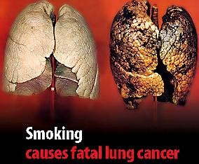 healthy+unhealthy+lungs.jpg