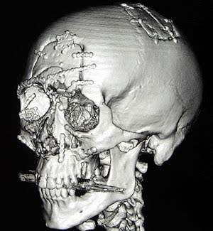 [injury+head.jpg]