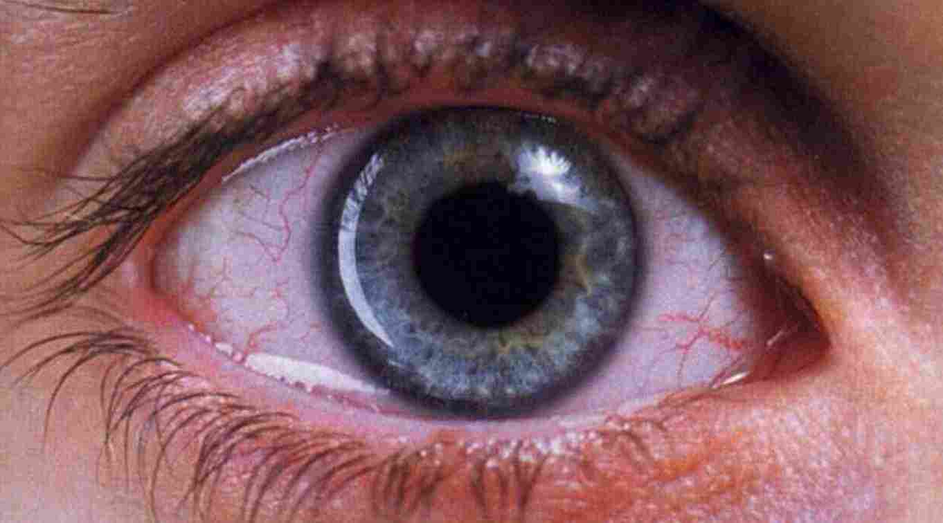 Tu oftalmóloga: Arte de ojos