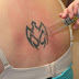 The Best Tattoo Ink Removal Methods 2010