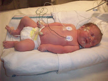 Lexi right after she was born