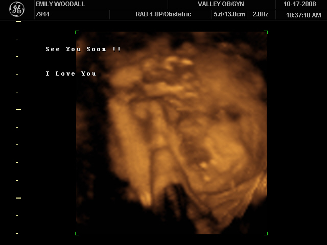 [31wk+ultrasound+018.jpg]