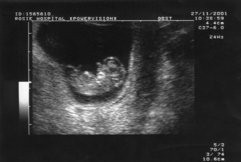 [ultrasound6_fs.jpg]