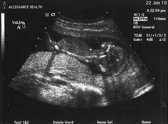 week 15 of pregnancy