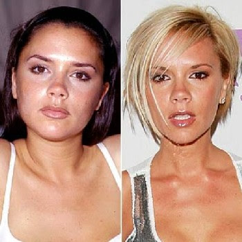Courtney  Plastic Surgery on Celebrities Plastic Surgery Before After Pictures 4 Jpg