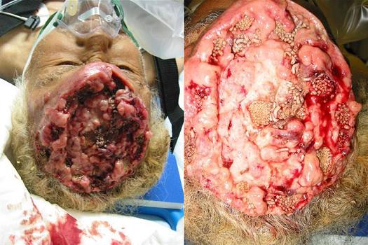 [Brain+Maggots.jpg]