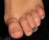 [th_mytoes.jpg]