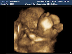 Baby Bart's First Photo Shoot