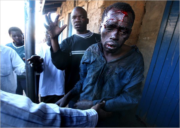 SOME OF THE KENYAN CASUALTIES!!