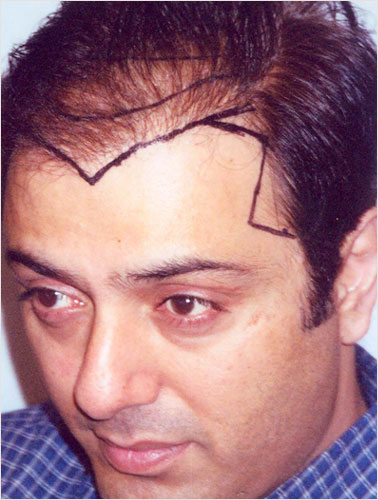 NOMAN EJAZ (T.V ACTOR BEFORE SURGERY)