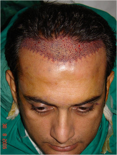 SHAHOOD ALVI ( T.V ACTOR BEFORE SURGERY)