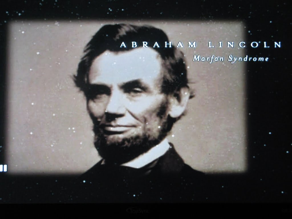 Abraham Lincoln Marfan