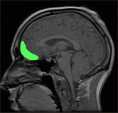 heightened sense of smell causes heightened sense of smell causes