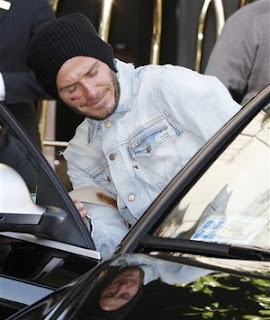 Beckham Achilles