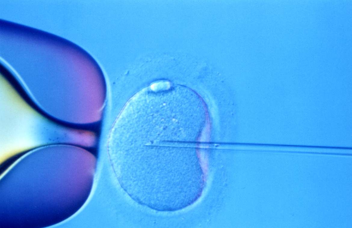 Ivf Infertility