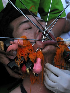 Getting impaled by multiple needles. Photo by Philip Clark.