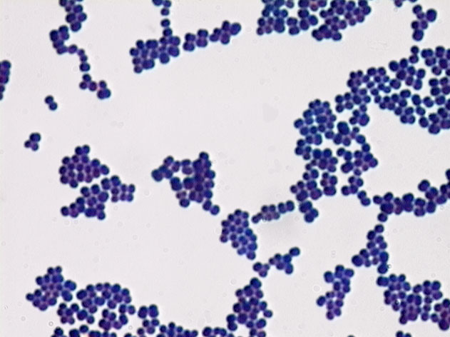 staphylococcus aureus gram stain. The Gram stain: even many lay