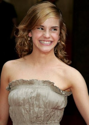 Daniel+radcliffe+and+emma+watson+kissing+in+deathly+hallows